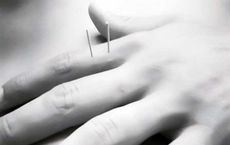 Learn About Acupuncture