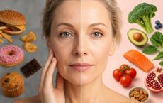 Article Image for The Connection Between Diet and Skin Aging